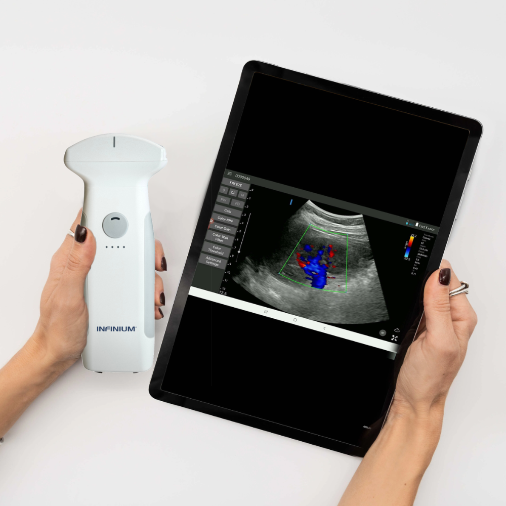 VioScan C7 - Convex Handheld Ultrasound