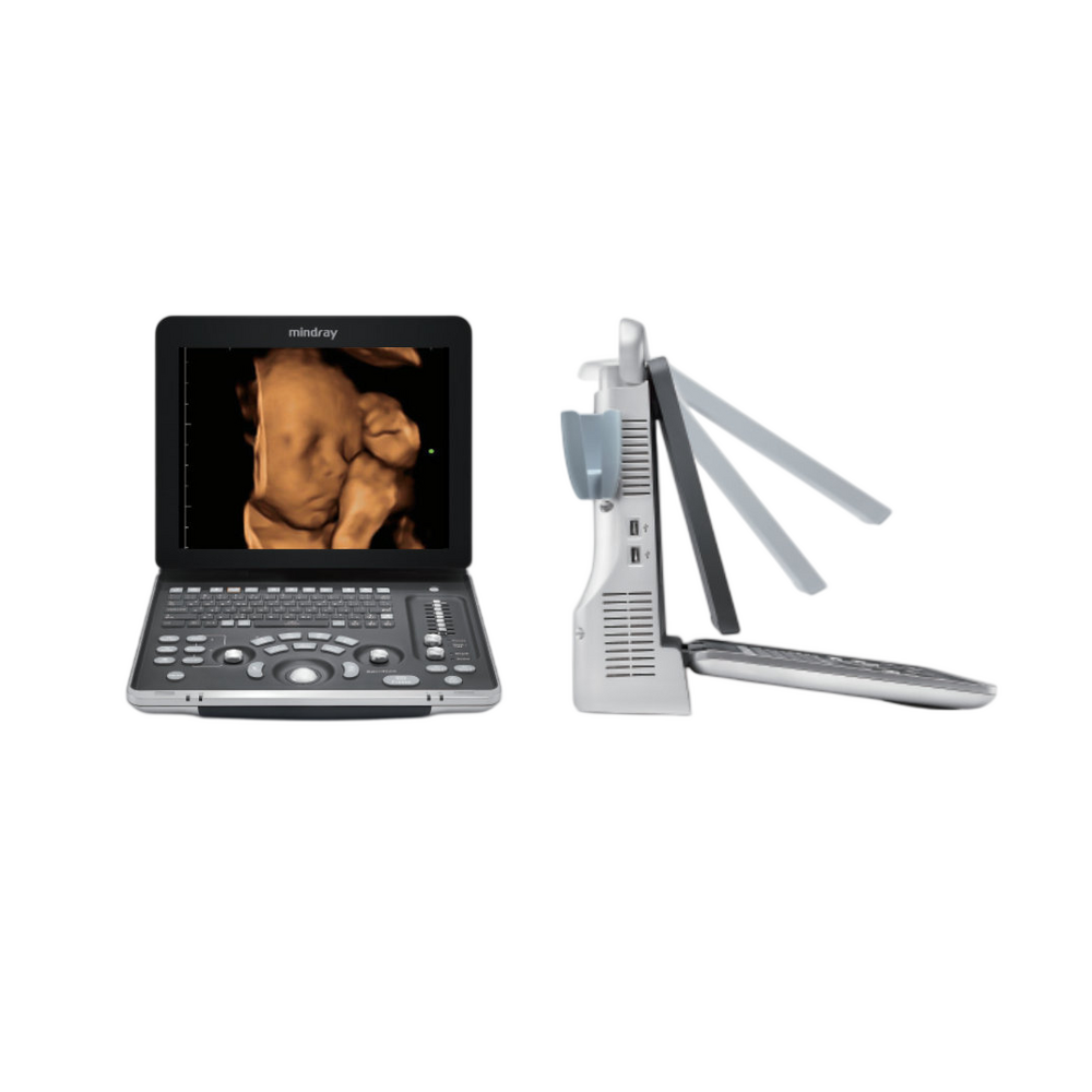 Mindray Z60 Portable Ultrasound System