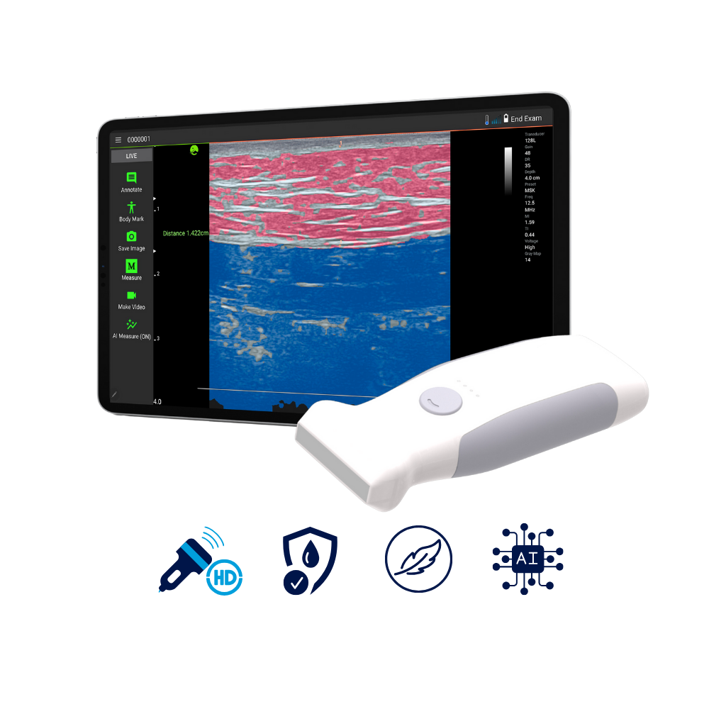VioScan L2 - Wireless Handheld Linear Ultrasound