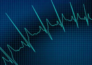 Hospital Vital Signs Monitor 