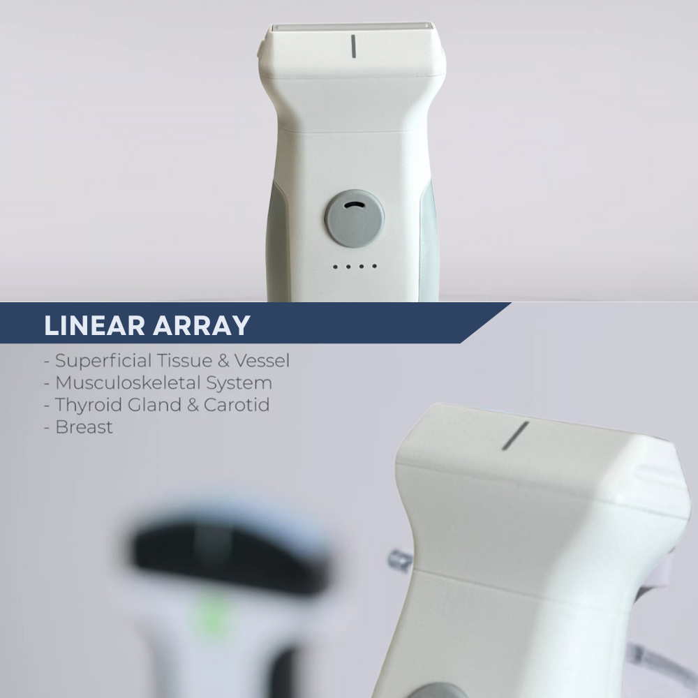 VioScan L2 - Wireless Handheld Linear Ultrasound