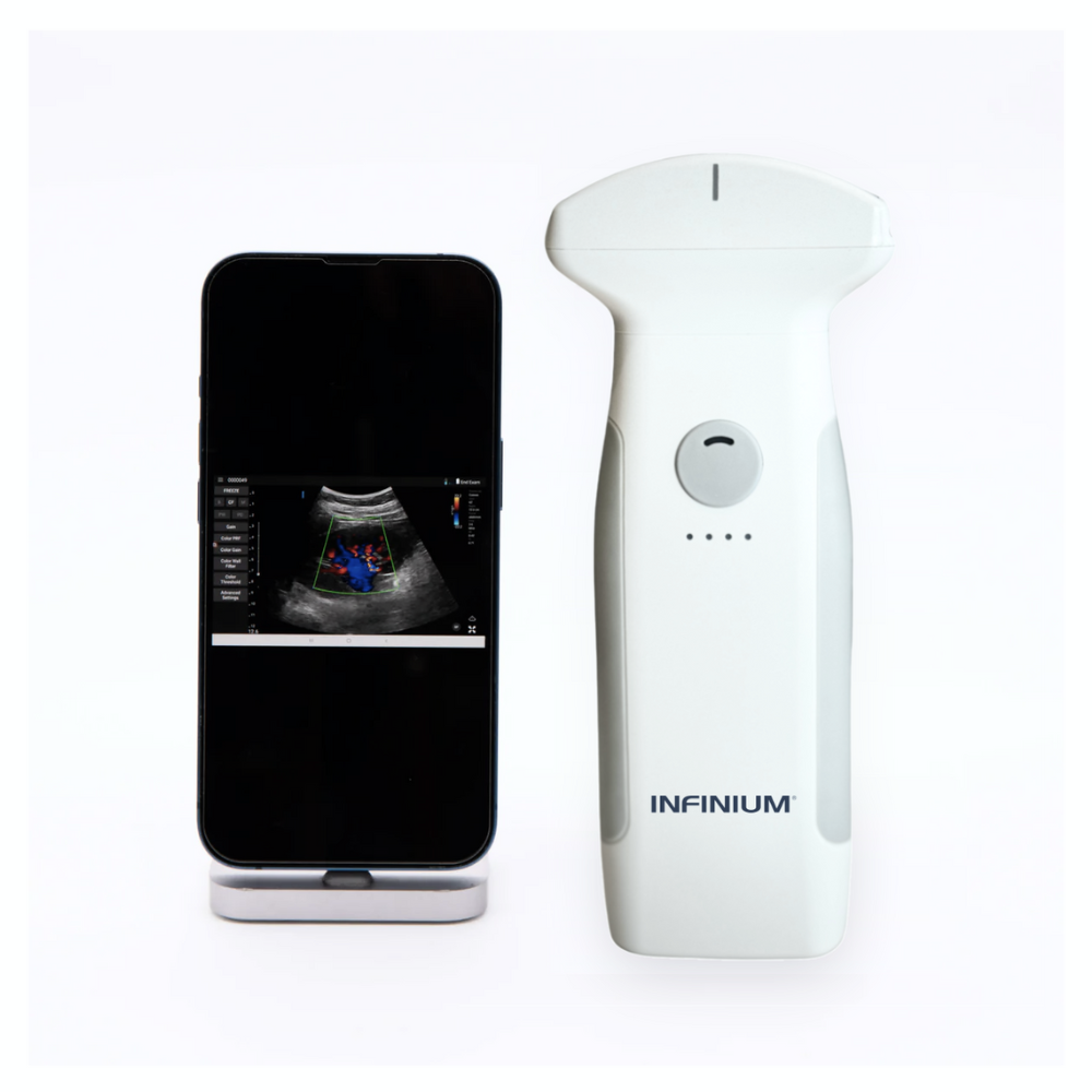 VioScan C7 - Convex Handheld Ultrasound