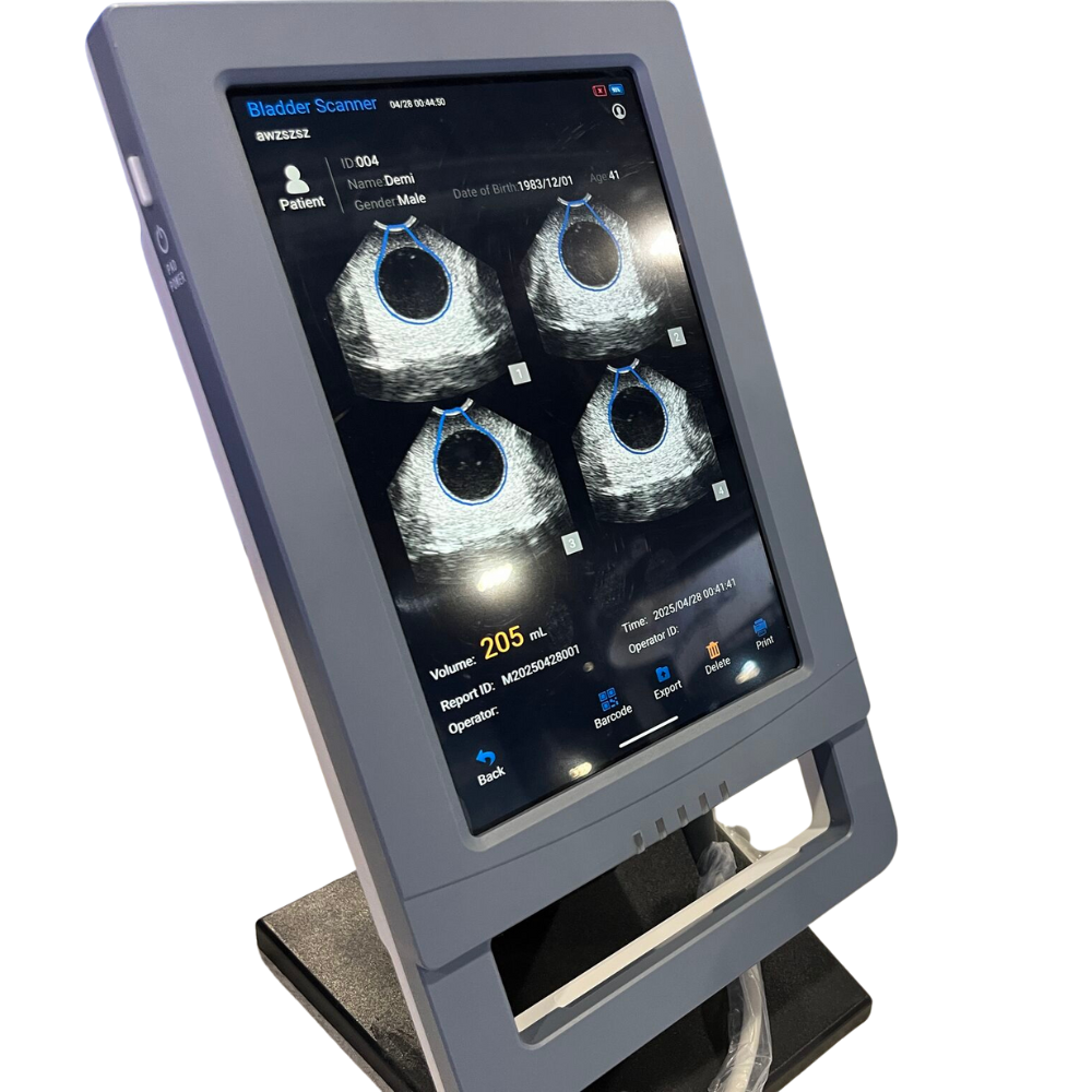 VioScan Portable Bladder Scanner